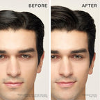 Dr. Groot Thickening Shampoo & Scalp Treatment Set for Hair Loss – Clinical Results with Biotin and Rosemary for Hair Thinning, Shedding, Scalp Repair and Treatment