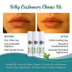 Moisturizing Tallow Lip Balm – Grass-Fed Beef Tallow with Organic Coconut Oil, Beeswax, and Vitamin E – Peppermint – Lip Balm Set – Travel Essential – 3-Pack