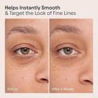 Alpyn Line-Filling Eye Balm with Bakuchiol & Caffeine, Reduce the Look of Fine Lines & Wrinkles, Minimize the Appearance of Puffiness & Target Dark Circles, 0.5 oz / 14 ml