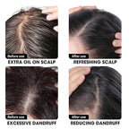 Anti Dandruff Shampoo - Scalp Deep Cleansing, Excess Sebum Care, Natural Ingredients - For Women & Men, Soothes Itchy, Dry Scalp, 16.8 fl.oz