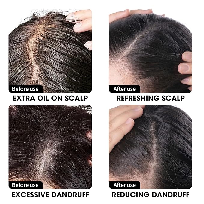 Anti Dandruff Shampoo - Scalp Deep Cleansing, Excess Sebum Care, Natural Ingredients - For Women & Men, Soothes Itchy, Dry Scalp, 16.8 fl.oz