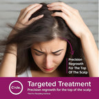 Minoxidil for Women 5% Foam - Helps Restore Top of Scalp Hair Loss and Support Hair Growth for Women, Regrowth with Unscented Topical Treatment for Thinning Hair (5% Foam 4-Month Supply)