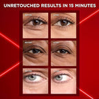 L'Oreal Paris Revitalift Triple Power Eye Bag Instant Eraser, Eye Tightener Treatment to Firm Bags, 0.5 oz + Moisturizer Sample