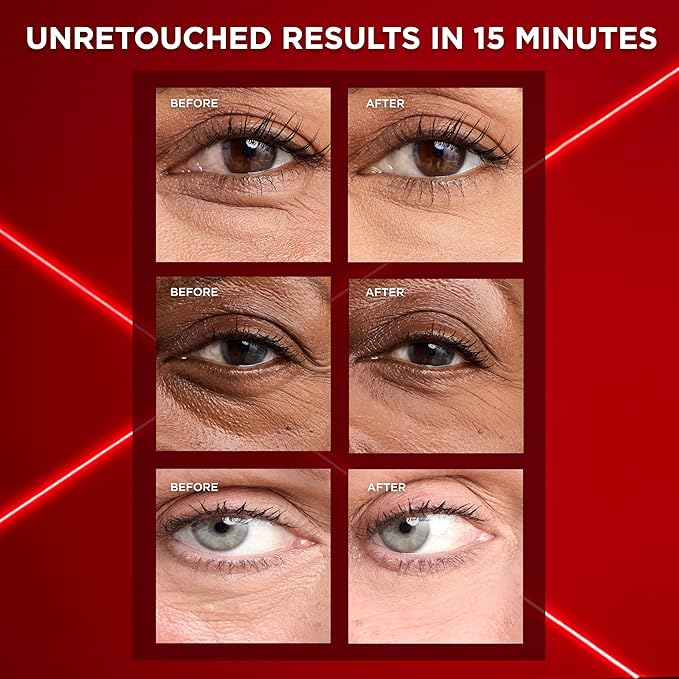 L'Oreal Paris Revitalift Triple Power Eye Bag Instant Eraser, Eye Tightener Treatment to Firm Bags, 0.5 oz + Moisturizer Sample