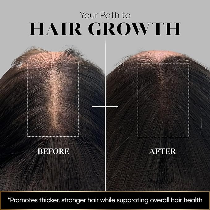 Vita Hair (Micronized Formula) Growth & Hair Loss Supplement – 100% Natural for Healthier Hair – Supports Hair Growth, Reduces Hair Loss, and Combats Graying for Men & Women – 108 Capsules