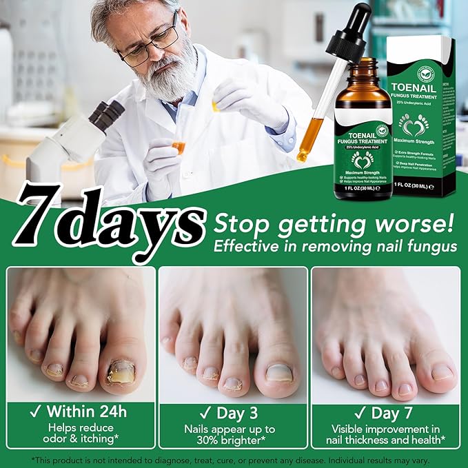 2Pack Toenail Treatment with 25% Undecylenic Acid, Nail Renewal, Promotes Nail Health,Enrich jojoba oil and vitamin E nourish the nail and & Skin,Safe & Gentle Repairing Damaged Nails