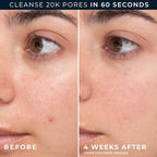 RoC Barrier Renew Gel to Foam Non Drying Foaming Facial Cleanser to Hydrate Skin, facial cleanser for sensitive skin, 12 Ounces