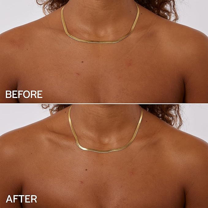 WHIND Hydrating Self-Tanning Body Mist – Lightweight Bronzing Spray with Hyaluronic Acid & Glycerin for a Natural Tan – 200ml