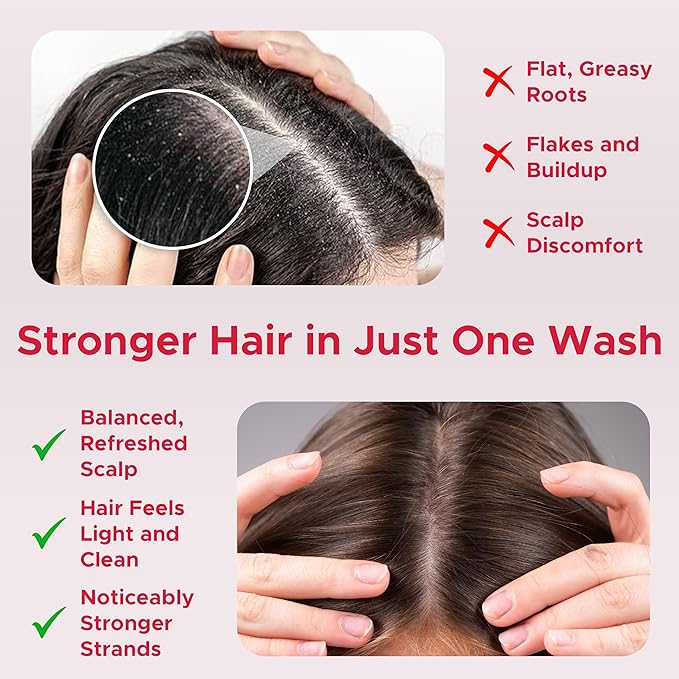 Nora Ross Garlic Extract Oil Control Clarifying Shampoo with Rosemary – Strengthening Shampoo for Women and Men – Deep Cleansing Vegan Formula for Build Up and Greasy Scalp with Fresh Chamomile – 32oz