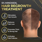 Elevate Hair Regrowth Treatment 5% Minoxidil Solution for Hair Growth - Extra Strength Topical Hair Growth Serum for Thicker, Fuller Hair 2 Fl Oz Made in USA