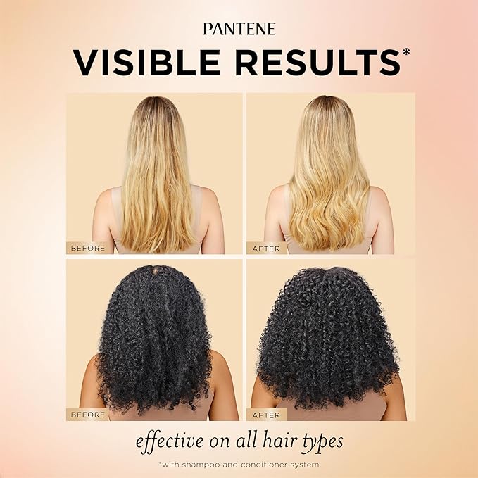 Pantene Abundant & Strong 3-Piece Regimen with B5 Complex + Niacinamide, Shampoo (13.5 oz), Conditioner (8 oz), Serum (2 oz) for Hair Loss, Thinning, Anti-Breakage, Volume - Grows Healthier