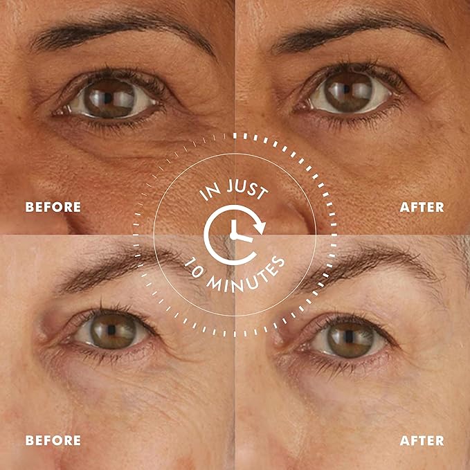 skyn ICELAND Hydro Cool Firming Under Eye Patches. Eye Gel Mask to Firm And Reduce Wrinkles, Fine Lines, Dark Circles, Puffy Eyes & Bags, 4 Pairs