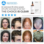 HairStem Follicle-boosting Triceutical Serum for Thicker Fuller Hair | Triple-Action, Multi-Zonal Topical Serum for Hormonal, Nutritional, and Inflammatory-Related Hair