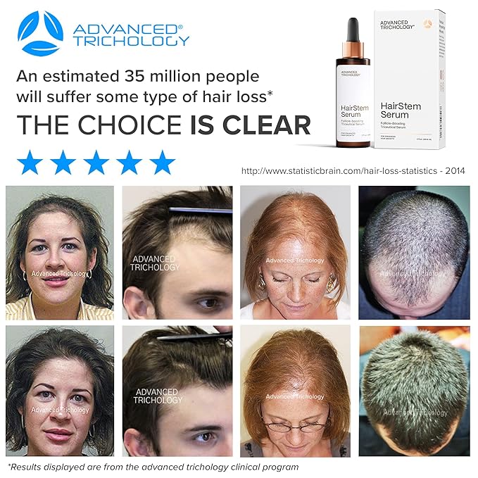 HairStem Follicle-boosting Triceutical Serum for Thicker Fuller Hair | Triple-Action, Multi-Zonal Topical Serum for Hormonal, Nutritional, and Inflammatory-Related Hair