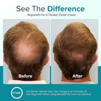 Minoxidil for Men Foam 5% - Unscented 6 Month Supply - Helps Restore Vertex Hair Loss & Thinning - 5% Minoxidil Foam For Men - Extra Strength Supports Hair Regrowth