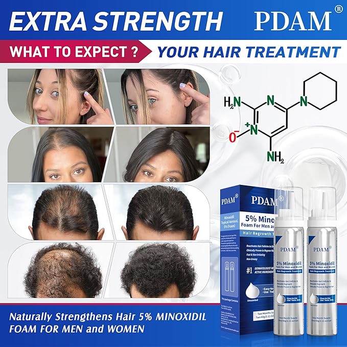 5% Minoxidil for Men and Women Foam Hair Growth - Minoxidil Foam Hair Regrowth Treatment for Men and Women, Topical Hair Loss Treatments, Extra Strength Thicker & Fuller Hair, 2 x 2.11 oz for 2 Months