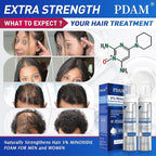 5% Minoxidil for Men and Women Foam Hair Growth - Minoxidil Foam Hair Regrowth Treatment for Men and Women, Topical Hair Loss Treatments, Extra Strength Thicker & Fuller Hair, 2 x 2.11 oz for 2 Months