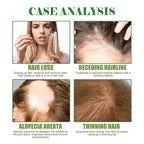 100% Pure Organic Rosemary Essential Oil for Hair Growth - Multi-Purpose Hair Treatment Oil Promotes Eyelash & Eyebrow Growth, 2.02fl oz (Small, Rosemary)