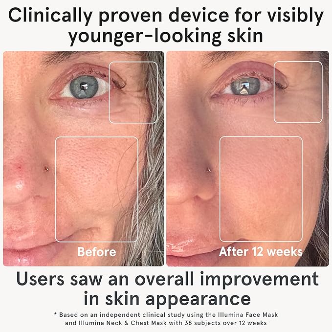 iRestore LED Face Mask for Youthful Skin, Red Light Therapy for Face, Red, Blue & Infrared Therapy for Wrinkles, Fine Lines, Dark Spots with 360 LEDs, Skincare Device for Women & Men