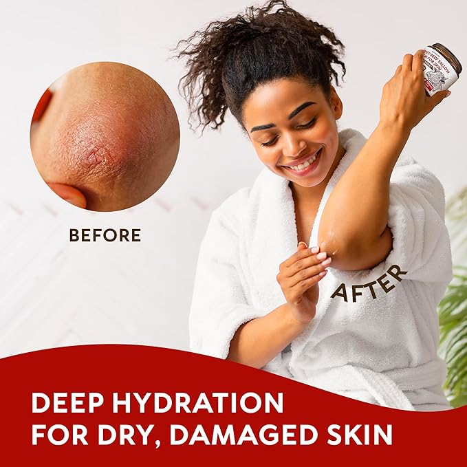 Beef Tallow for Skin - Whipped Tallow and Honey Balm - Grass Fed Beef Tallow for Face, Daily Moisturizer & Body Butter - Natural Non Comedogenic Skincare (4.3 oz)