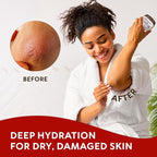 Beef Tallow for Skin - Whipped Tallow and Honey Balm - Grass Fed Beef Tallow for Face, Daily Moisturizer & Body Butter - Natural Non Comedogenic Skincare (4.3 oz)