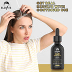 Elevate Hair Regrowth Treatment 5% Minoxidil Solution - Biotin Serum Hair Growth Oil for Men & Women - Thicker Fuller Stronger Hair - Stops Hair Loss & Thinning - Natural Hair Thickening Treatment 1oz