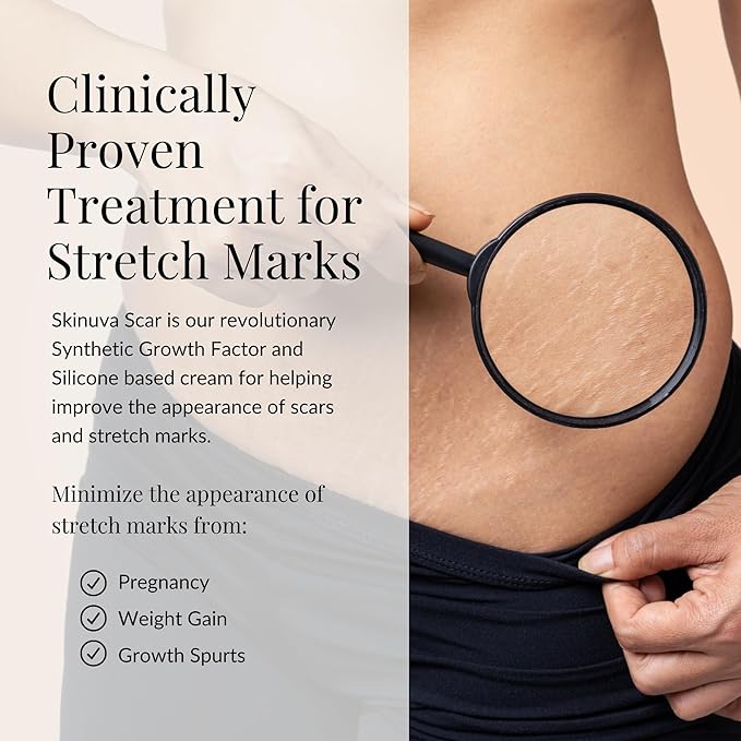 Skinuva® Next Generation Scar Cream - Stretch Mark Cream Made with Growth Factors, Hyaluronic Acid & Vitamin C for Intense Stretch Mark Removal (2.5 oz)