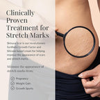 Skinuva® Next Generation Scar Cream - Stretch Mark Cream Made with Growth Factors, Hyaluronic Acid & Vitamin C for Intense Stretch Mark Removal (2.5 oz)