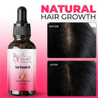 Hair Growth Oil - Ginger Scented, Pink, Unisex Adult, Promotes Thick Long Hair Growth, Suitable For All Hair Types, Vegan & Cruelty-Free