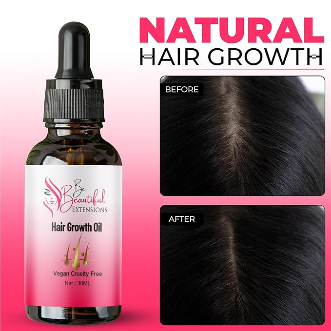 Hair Growth Oil - Ginger Scented, Pink, Unisex Adult, Promotes Thick Long Hair Growth, Suitable For All Hair Types, Vegan & Cruelty-Free