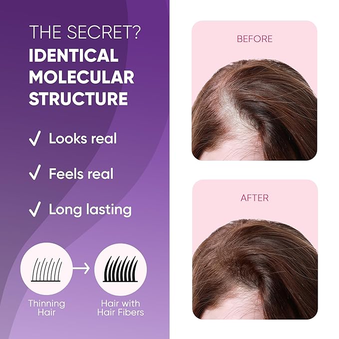 GBG Hair Fibers for Thinning Hair & Bald Spots (Auburn) - 25g Bottle - Conceals Hair Loss - Instant Cover Up & Volume in 30 Seconds, Hair Powder for Women & Men - Cruelty Free