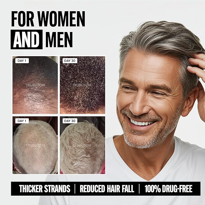 Tru Bloom Hair Growth Vitamins - 1 Month Supply. Clinically Proven to Grow Fuller, Thicker Hair. Drug-Free with Biotin, Collagen, Keratin, MSM, Zinc, D3 + Hair Superfoods