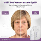 Beverly Hills V-Lift Instant Eye Lift and Eye Tuck Bee Venom Serum for Puffy Eyes, Dark Circles, Wrinkles, and Under Eye Bags Treatment for Women and Men | 30mL (120 Day Supply)