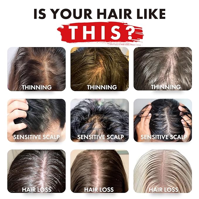 ALFHEIM Coffee+ Thickening Shampoo for Fine, Weak & Thinning Hair with Caffeine, Biotin & Arabica Coffee Oil – Energizing, Strengthening & Volumizing Cleanser – Sulfate-Free, Cruelty-Free – 10.7 oz