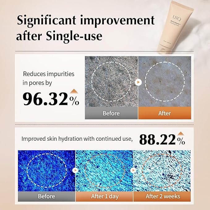 UIQ Biome Barrier Cleansing Foam, Facial Cleanser, Mild Hypoallergenic formula, Face Wash, Blackhead Remover, Moisturizing facial cleanser for All Skin Types 4.05 fl.oz(120ml)