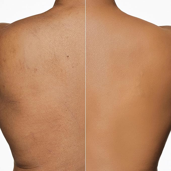 Dermablend Leg and Body Makeup Foundation with SPF 25, 45W Tan Honey, 3.4 Fl. Oz.