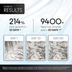 AM/PM Hair Growth Serums for Women & Men – Redensyl Capixyl Procapil GHK-CU Multi-Peptide & Stem Cell Formula| DHT Blocker Topicals | Regrowth Treatment | Hair Loss Support Bundle | Follicle Spray