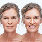 MAREE Blemish Acne Clearing Polishes - Daily Facial Radiance Toner Pads - Witch Hazel Pads Acne Face Toning - Acne Skin Care with BHA Salicylic Acid - Blemish Clearing Witch Hazel Device