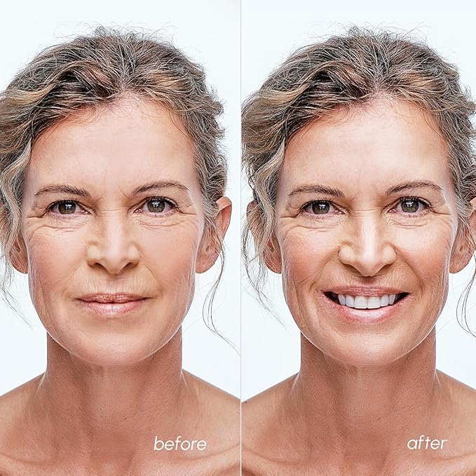 MAREE Blemish Acne Clearing Polishes - Daily Facial Radiance Toner Pads - Witch Hazel Pads Acne Face Toning - Acne Skin Care with BHA Salicylic Acid - Blemish Clearing Witch Hazel Device