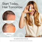 Peptide Vegan 5% Hair Growth Serum With Capixyl - Hair Growth Products for Men & Women Helps Reduce Hair Loss, Strengthen & Thicken Vegan Hair Serum for Thinning Hair
