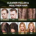 Batana Oil Hair Growth Shampoo, Strengthening Regrowth Shampoo for Men & Women with Thinning Hair & Hair Loss, Infused Rosemary, Mint Oil Nourishes Scalp, Sulfate Free for All Hair Types, 10.15 fl.oz