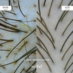 Detox + Restore Duo – Shampoo & Conditioner Set for Scalp Health & Hydration – Microbiome Reset & Frizz Control with Peptides & Hyaluronic Acid (2 x 8.45 oz)