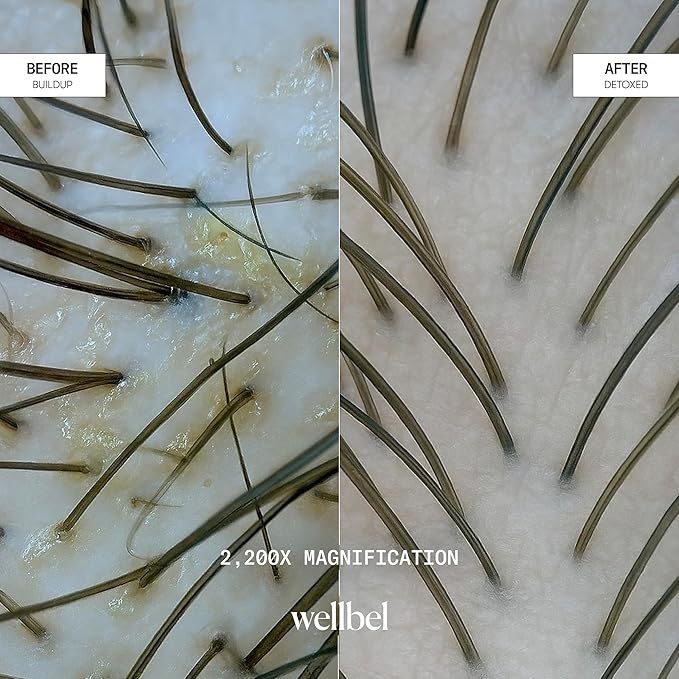 Detox + Restore Duo – Shampoo & Conditioner Set for Scalp Health & Hydration – Microbiome Reset & Frizz Control with Peptides & Hyaluronic Acid (2 x 8.45 oz)