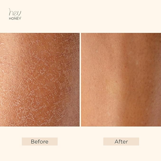 Hey Honey Skin Care Mango & Honey Water-Free Body Lotion - Hyaluronic Acid, Ceramides & Barrier Repair for Hands, Elbows & Dry Sensitive Skin | 24-Hr Hydration, Fruit Enzymes, Cruelty-Free | 6.7 oz