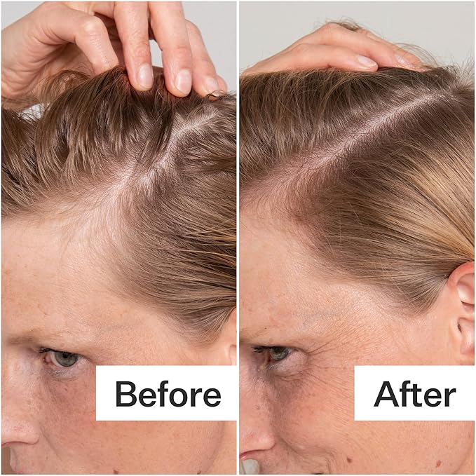 Act+Acre Cold Processed Salicylic Acid Exfoliator | For Loose Flakes, Excess Oil, Scalp Build-Up | Salicylic Acid, Papaya, Peppermint | Balance, Soothe | Vegan, Color Safe, Fragrance-Free | 2 Fl Oz