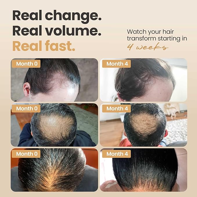 Vitasei Hair Booster 2 Fl Oz – Hair Revitalizing Serum with Capilia Longa, Wild Olive Stem Cells & Arginine – Peptide-Enriched Hair Tonic for Thicker, Stronger Hair – Natural Hair Care for Women & Men