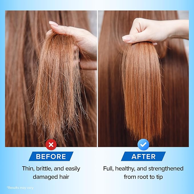 Biotin Shampoo and Conditioner Set - Hair Growth Shampoo and Conditioner for Men & Women - Shampoo Conditioner for Dry, Damage & thinning hair with Tea Tree, Manuka Honey & Rosemary 16oz