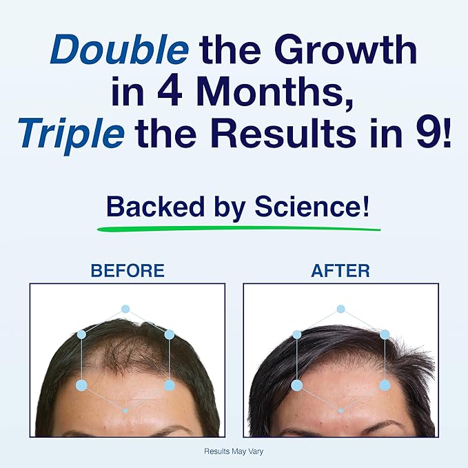 Patented Hair Growth Vitamins for Women & Men | Clinically Proven Hair Loss Supplement for Visibly Thicker Fuller Hair | Dr. Recommended Hair Vitamins for Hair Loss and Thinning | 1 Month Supply