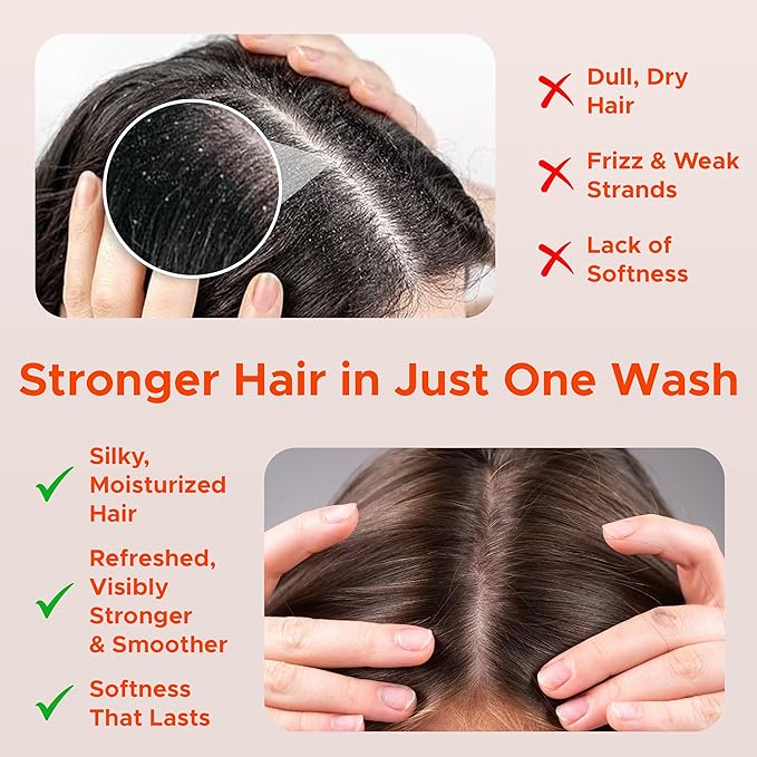 Nora Ross Garlic Extract Strengthening Conditioner with Sesame Seed Oil – Natural Deep Hair Conditioner for Women and Men with Dry, Damaged, Thinning Hair – Hydrating Paraben-Free Treatment – 32oz