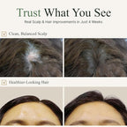 TS Gold Plus Shampoo | Hair Loss Shampoo with Biotin, Gold Extract & Niacinamide | Scalp Circulation & Volume Care | Sulfate-Free Korean Hair Care for Thinning Hair (17.6 Fl Oz / 500mL)